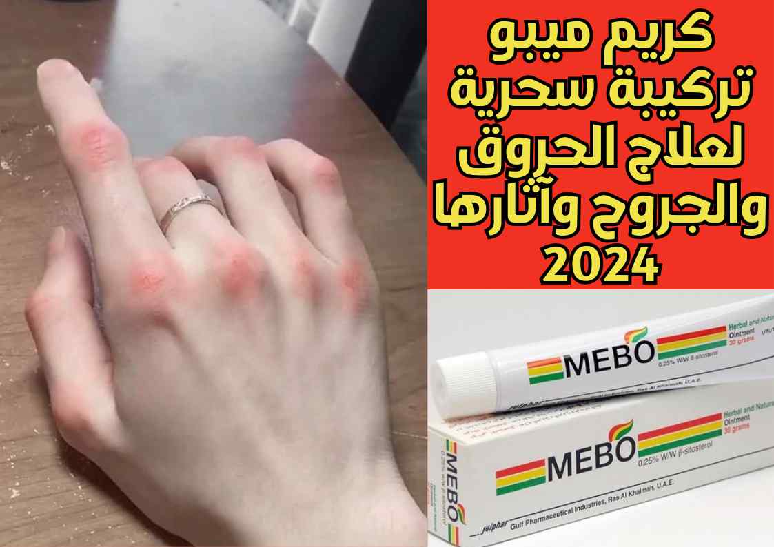 كريم ميبو تركيبة سحرية لعلاج الحروق والجروح وآثارها 2024