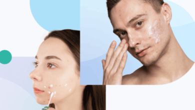 أنواع حب الشباب و علاجه بالوصفة الطبية